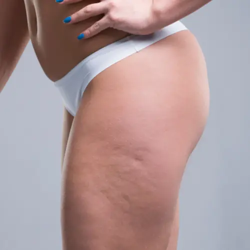 Woman in white underwear