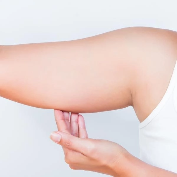 Get Slimmer, Smoother Arms with Liposuction