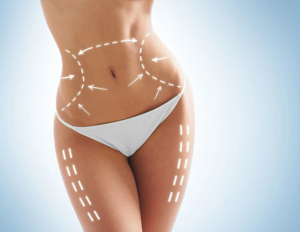 How Much Does Liposuction Cost