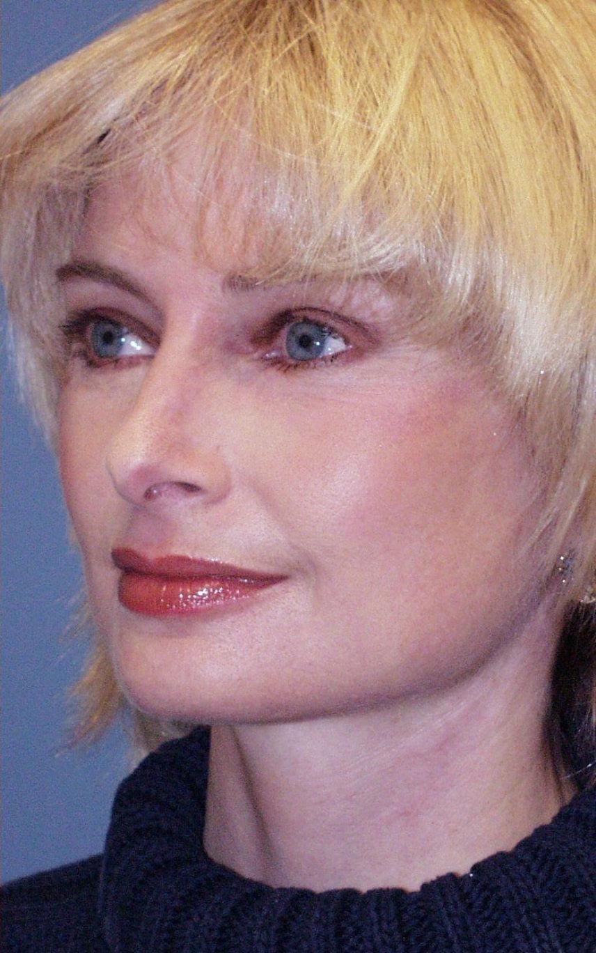 Facelift Patient Photo - Case 14168 - after view-2