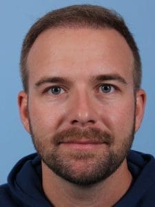 Hair Restoration - Case 14332 - After