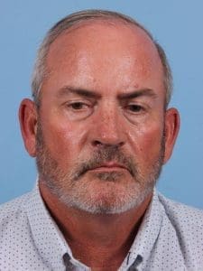 Hair Restoration - Case 14342 - Before