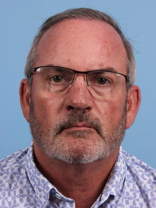 Hair Restoration Patient Photo - Case 14342 - after view