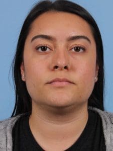 Laser Hair Reduction - Case 14471 - After