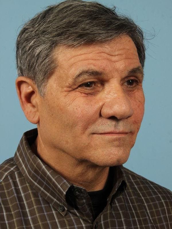 Injectable Fillers Patient Photo - Case 14735 - after view-4