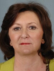 Facelift - Case 15188 - After