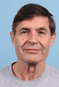 Facelift - Case 15765 - Before