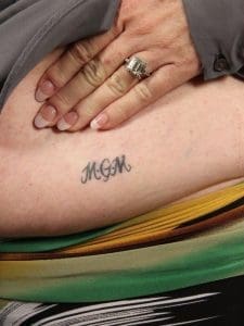 Laser Tattoo Removal - Case 15995 - Before