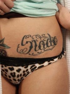 Laser Tattoo Removal - Case 16038 - Before