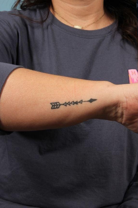 Laser Tattoo Removal Patient Photo - Case 16073 - before view-1