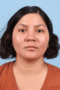 Laser Skin Treatments - Case 16259 - After