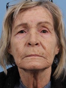 Case 16378 - Before
