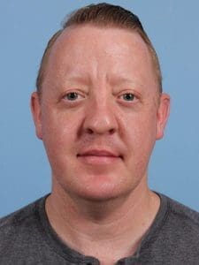 Renuvion - Case 16420 - Before