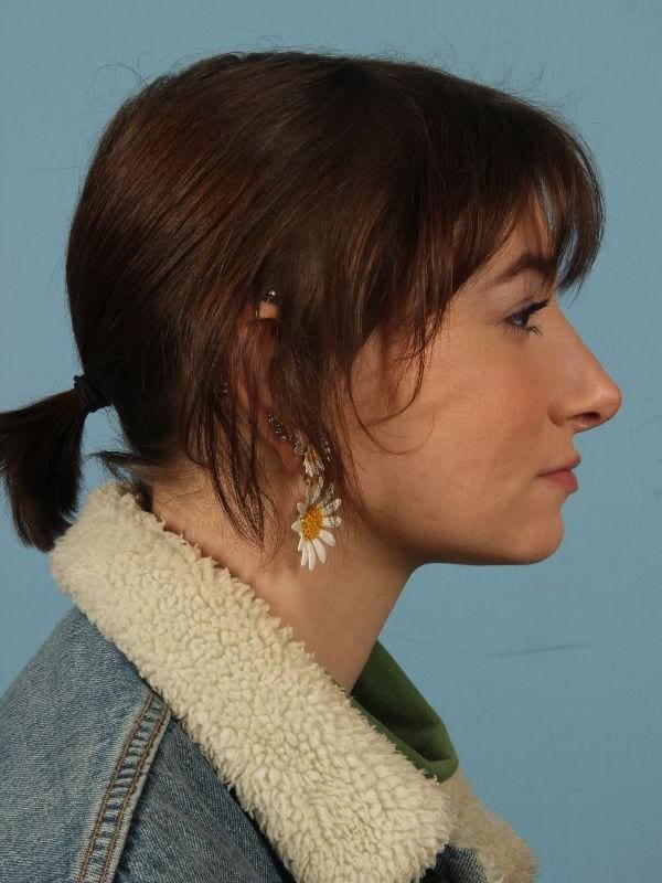 Rhinoplasty Patient Photo - Case 16513 - after view-2