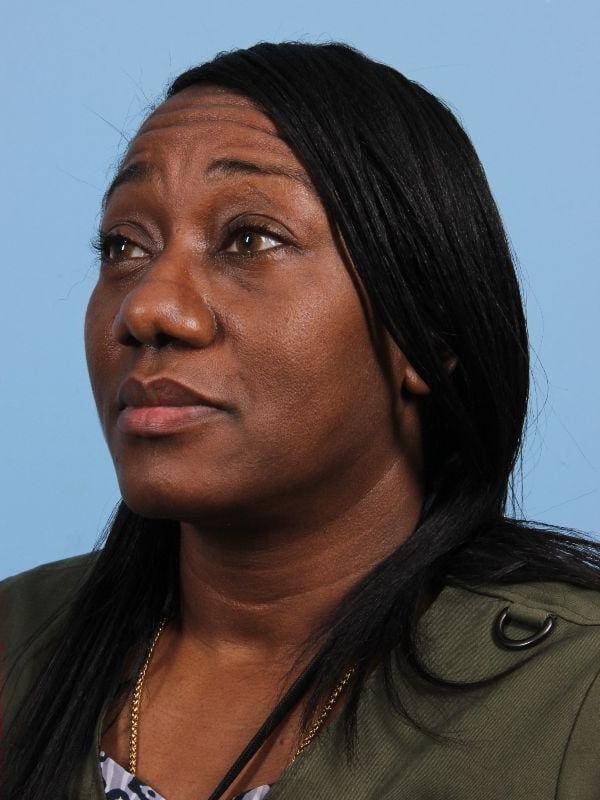 Rhinoplasty Patient Photo - Case 16551 - after view-3