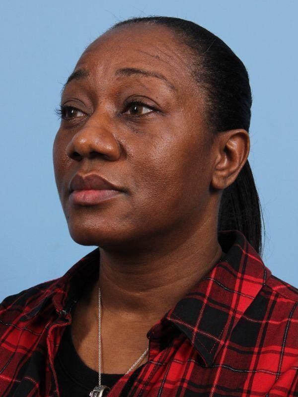 Rhinoplasty Patient Photo - Case 16551 - before view-3