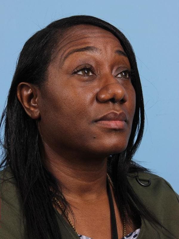 Rhinoplasty Patient Photo - Case 16551 - after view-4