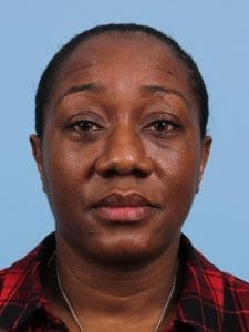 Rhinoplasty - Case 16551 - Before