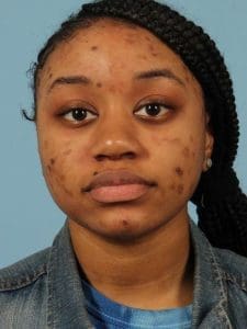 Skin Resurfacing - Case 16589 - After