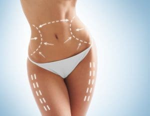 How Much Does Liposuction Cost?
