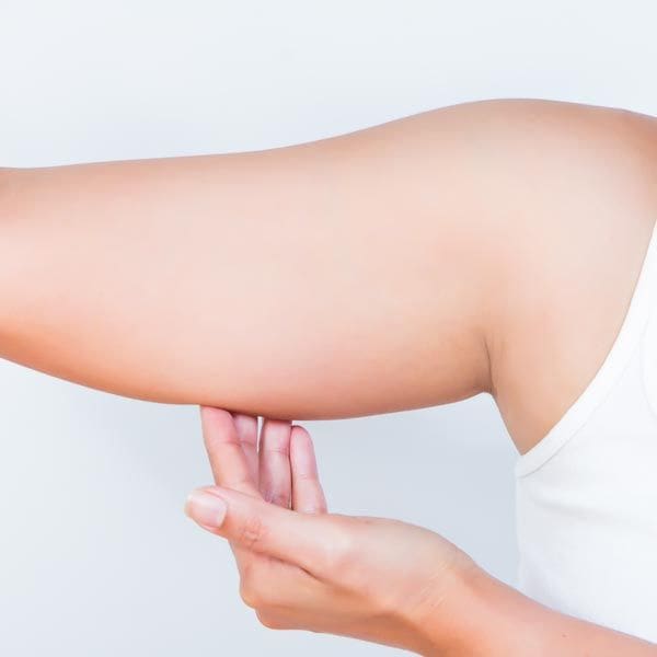 Get Slimmer, Smoother Arms with Liposuction