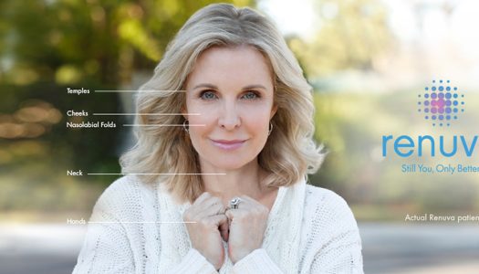 Renuva by Dr. Suzanne Yee Renuva by Dr. Suzanne Yee