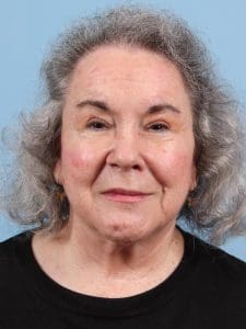 Hair Restoration - Case 23103 - After