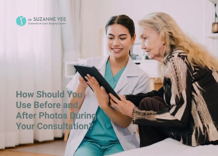 How Should You Use Before and After Photos During Your Consultation?