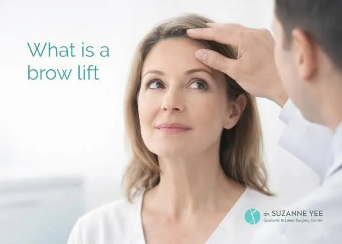 What Is a Brow Lift and Why Do Patients Choose This Procedure?