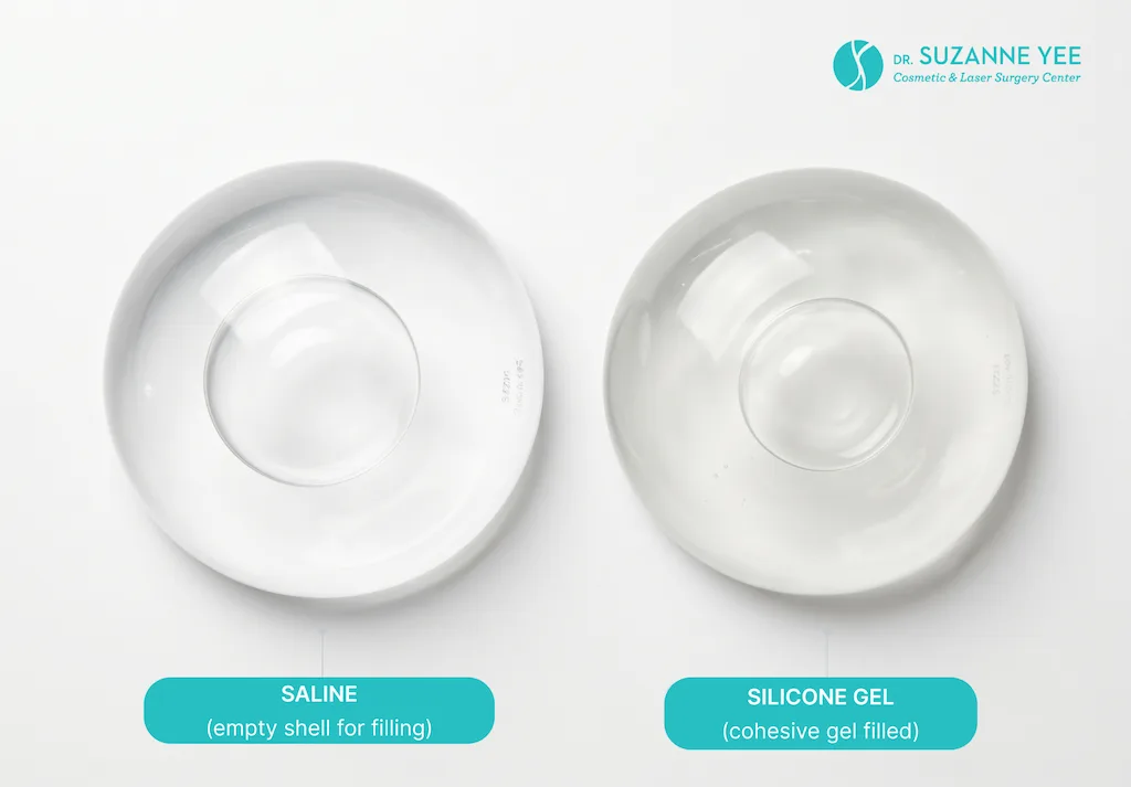 What types of breast implants should you consider?
