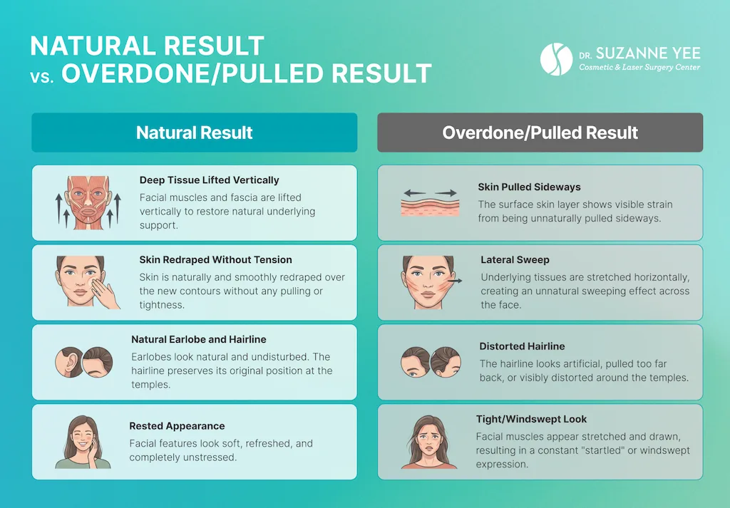 Why do some facelifts look natural while others look pulled or overdone?