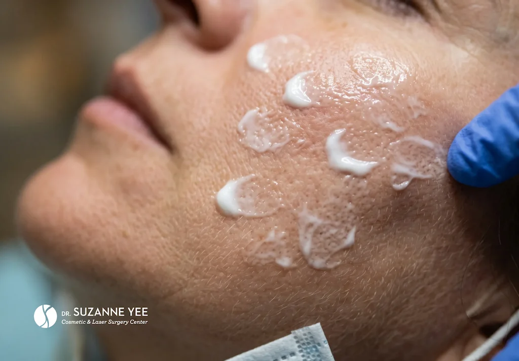 What is it actually like to undergo a non-surgical treatment?