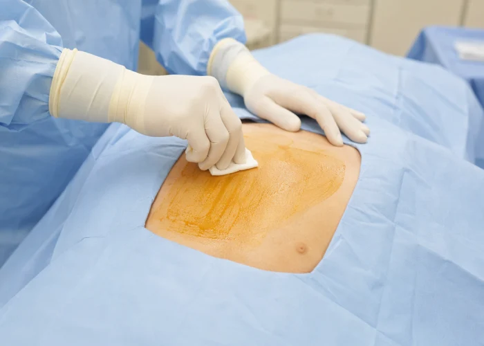 How can you lower your risks and choose a safe breast augmentation?